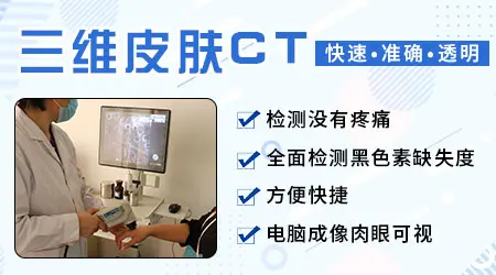 判断白癜风最简单方法