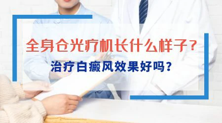 全身仓治疗白癜风一次多少钱