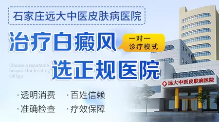 伍德灯检查白斑结果一个+一个-是什么意思