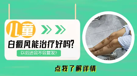 小孩白癜风有治好的吗