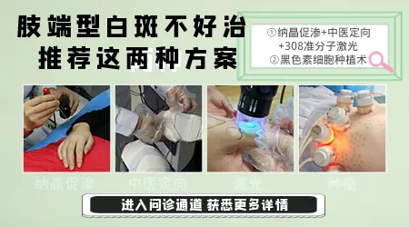 手上初期白斑症状图片