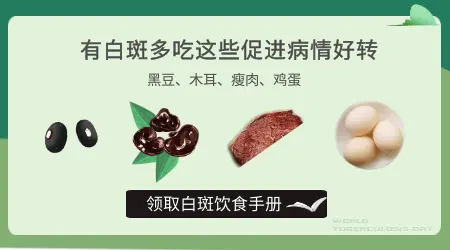 白癜风吃点什么好的快