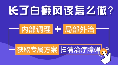 白癜风怎么出现那么多白点