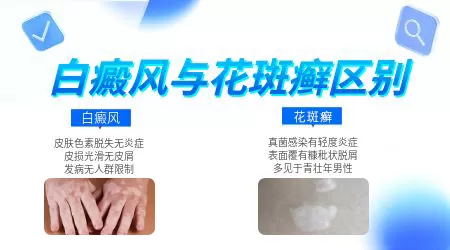 汗斑与白斑的区别