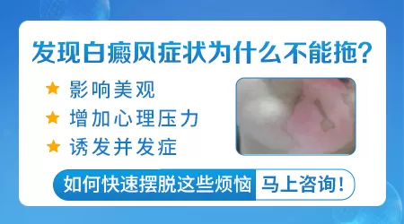 小孩白癜风白点图