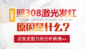 308激光治疗白癜风泛红正常吗