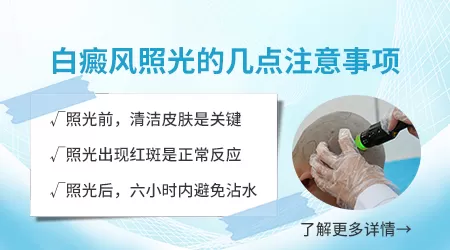 白癜风激光后擦他克莫司红