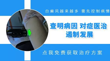 白斑越来越大是什么原因导致的