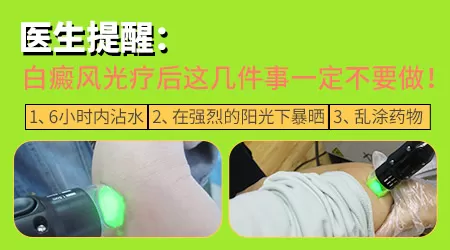 白癜风光疗红好还是不红好