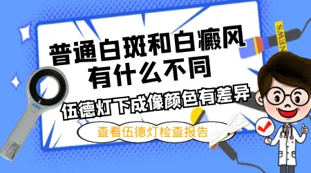 伍德灯下普通白斑和白癜风的区别