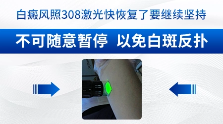 308激光治疗白斑一次费用是多少