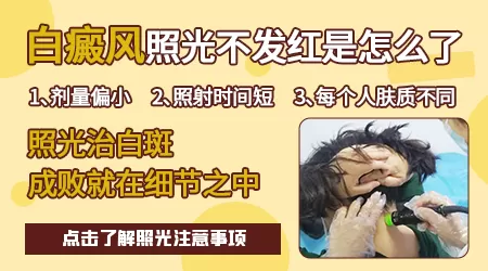 白癜风长黑点后照光不再发红了