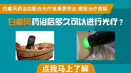 药浴治白癜风一个月几次