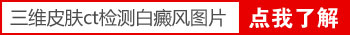 白斑治疗后由浅白变瓷白是变严重了吗