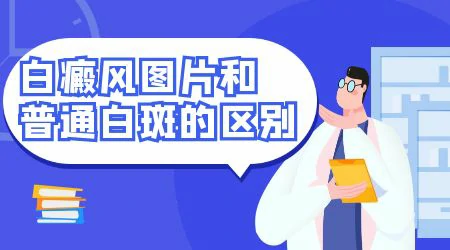 白斑和白癜风的区别是什么