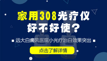 家用的光疗机能治好白癜风吗