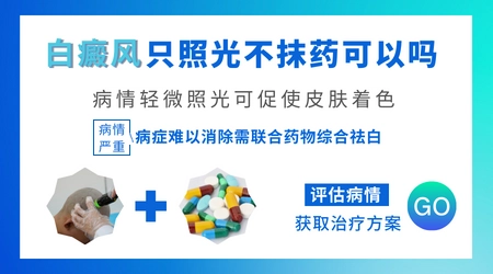 白癜风只照308不擦药可以吗