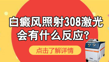 白斑周边正常皮肤照射到308准分子激光会有什么后果