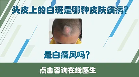 头上白一块怎么回事