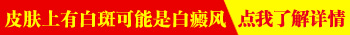 5岁宝宝脸上有白斑是什么 白斑还越长越大