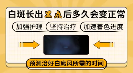 308照光白斑已经长黑色素了还有多久治好