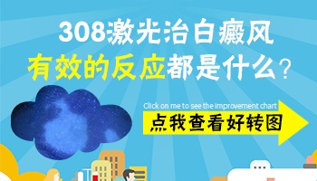 白癜风照308激光有效果会有什么反应