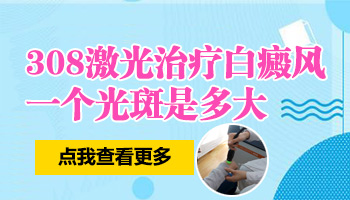 308激光照白癜风一个光斑有多大