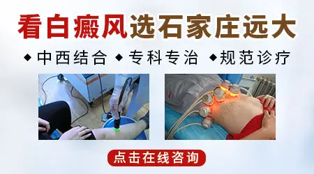 白癜风中医治疗方法有哪些