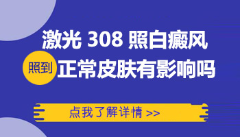 照光治疗婴幼儿白癜风的副作用是什么