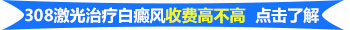 308激光治白癜风是治标不治本吗