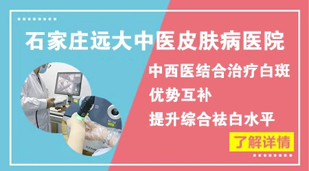 照308准分子激光白斑恢复过程是怎样的