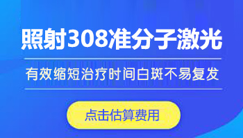 白癜风308激光一月照几次比较好