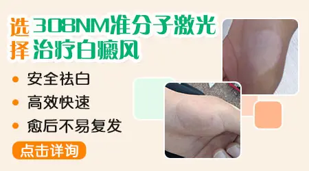 308激光照白斑多久一次好