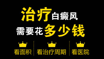 眼睛下边有晕痣型白癜风治好要多少钱