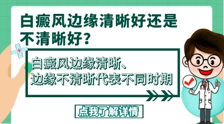 白癜风与周围皮肤边界清好吗