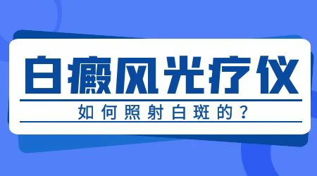 308激光和uvb紫外线光治疗白癜风有什么差距