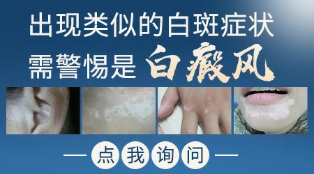 脸上长了白色的小圆斑点是什么