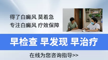 判断白癜风最简单方法是什么