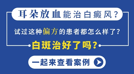 割耳朵放血能治疗白癜风吗