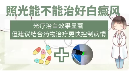 白癜风只照激光不吃药能行吗