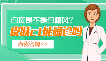 伍德灯下白斑是蓝白色荧光是白癜风吗