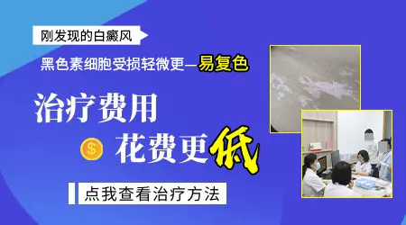 白癜风医院治疗白斑价格