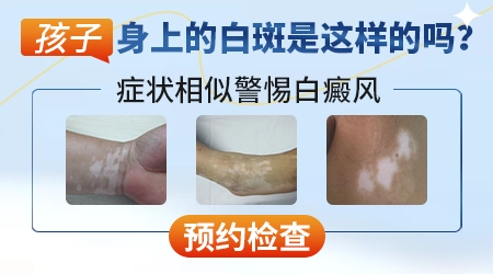 宝宝大腿根白一块怎么回事