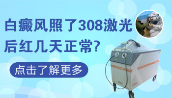 308激光照完白斑红几天比较好