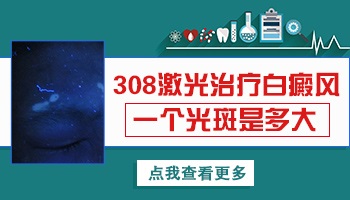 肚子上的白癜风照了激光起白泡泡怎么办