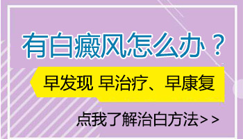 腹部白癜风照了308激光后能去根吗