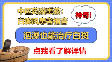 白癜风用什么泡澡比较好