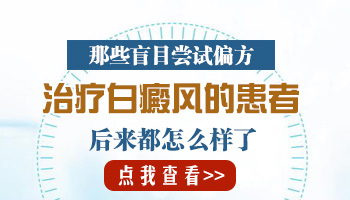 童子尿可以治白癜风吗 治白斑都有什么管用的偏方