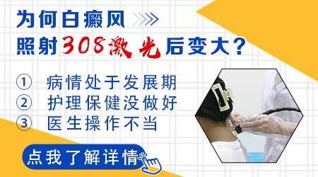 白斑做了308激光扩大