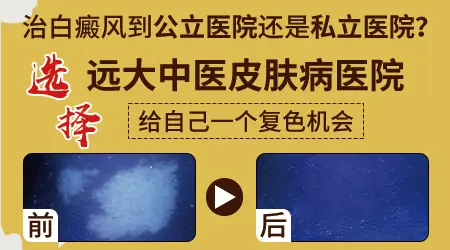 手上白斑能做黑色素移植吗